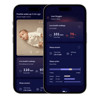 Owlet® Dream Sock – Owlet Okos zokni (matt rózsaszín) - Owlet - Biztonság - OduStore