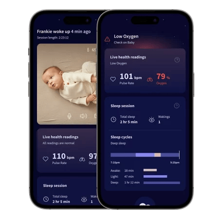 Owlet® Dream Sock – Owlet Okos zokni (matt rózsaszín) - Owlet - Biztonság - OduStore